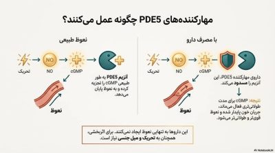 دوره درمان شلی آلت (عدم نعوظ)