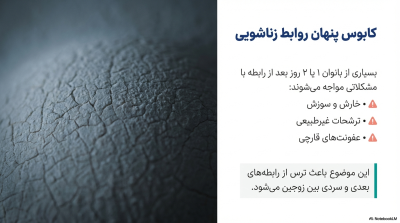 کاندوم ایکس دریم ضد قارچ و باکتری (بسیار چرب و روان)