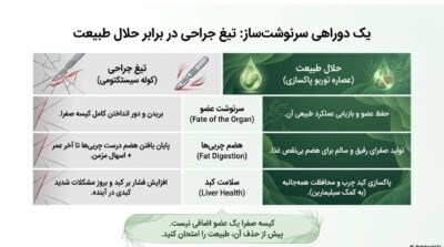 توربو پاکسازی صفرا | دفع قطعی سنگ صفرا و پایان دردهای خنجری | خرید قسطی